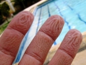 Морщинки на мокрых пальцах вполне объяснимы